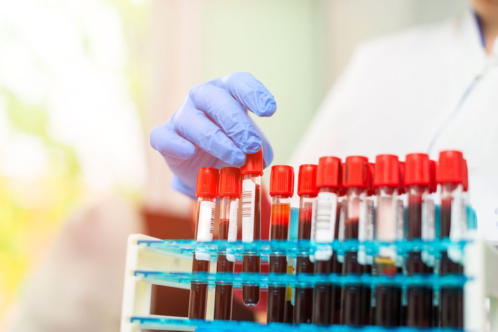 Kidney Function with Blood Test at Home in Dubai: Early Detection Matters