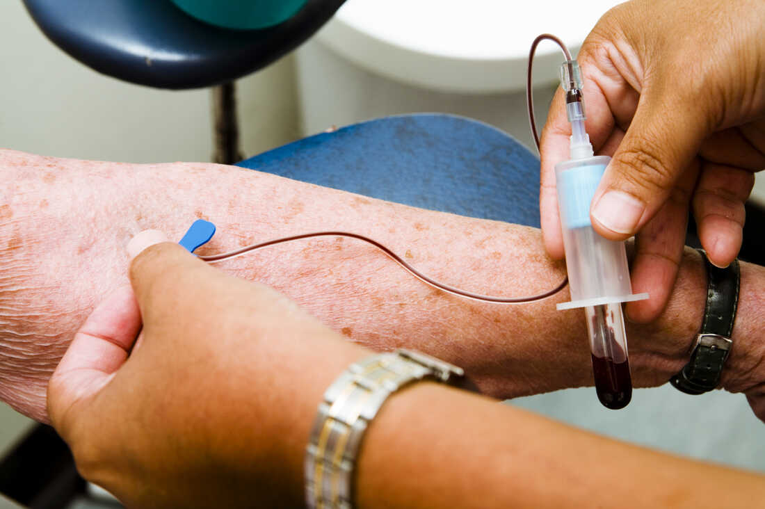 What Happens During a Blood Test at Home in Dubai?