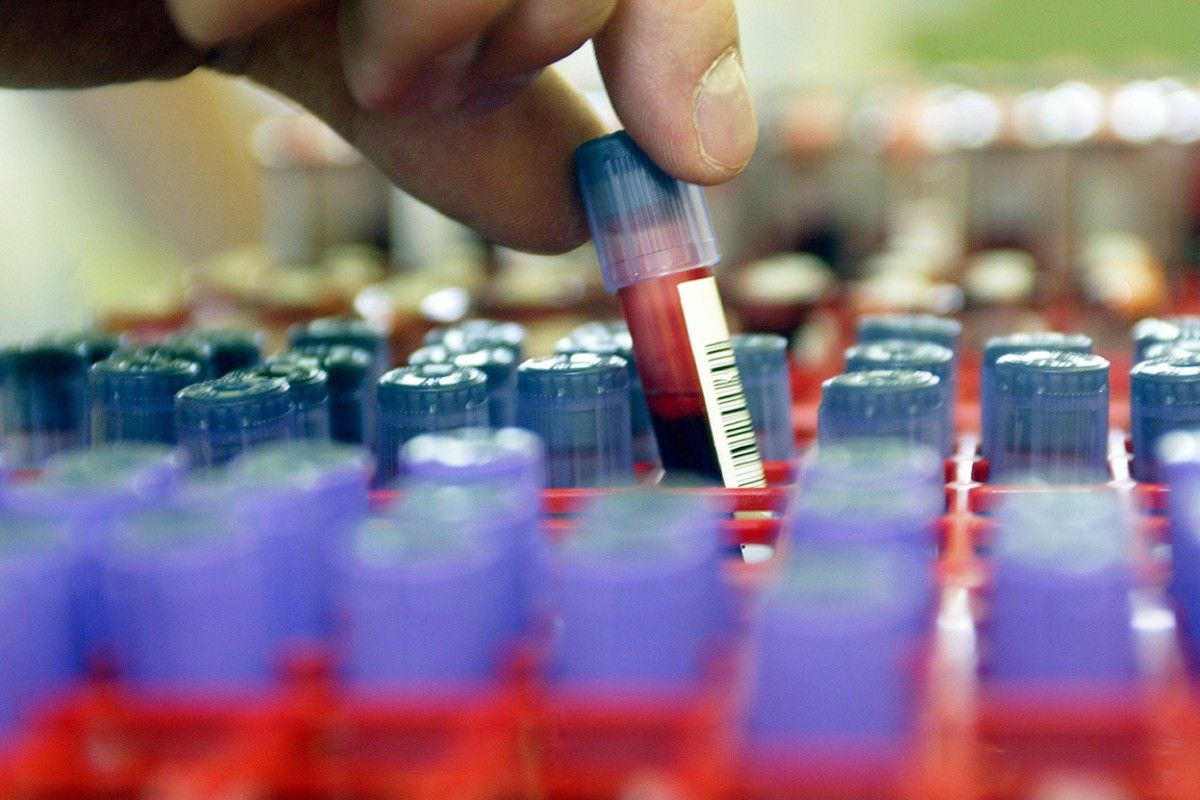 Can Blood Test at Home Predict ADHD or Bipolar Disorder?