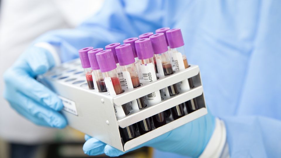 Accurate Blood Test at Home in Dubai – No Errors