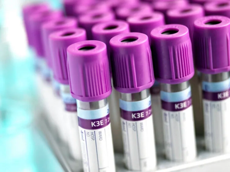 Blood Test at Home for People with PCOS