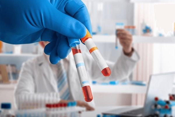 Blood Test at Home for Detecting Allergies and Sensitivities