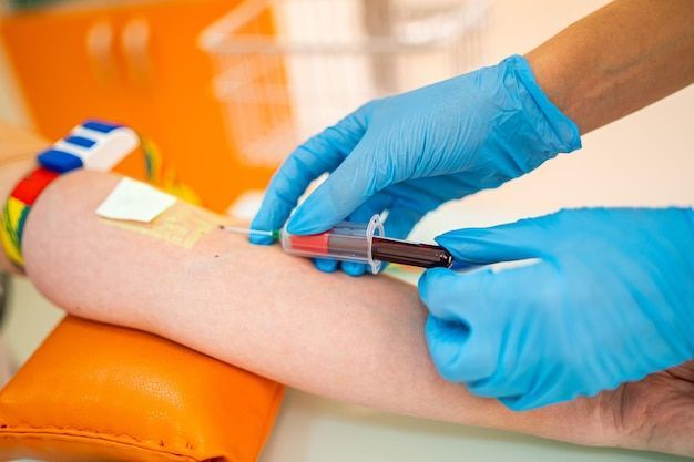 Do You Need a Doctor’s Prescription for Blood Test at Home?