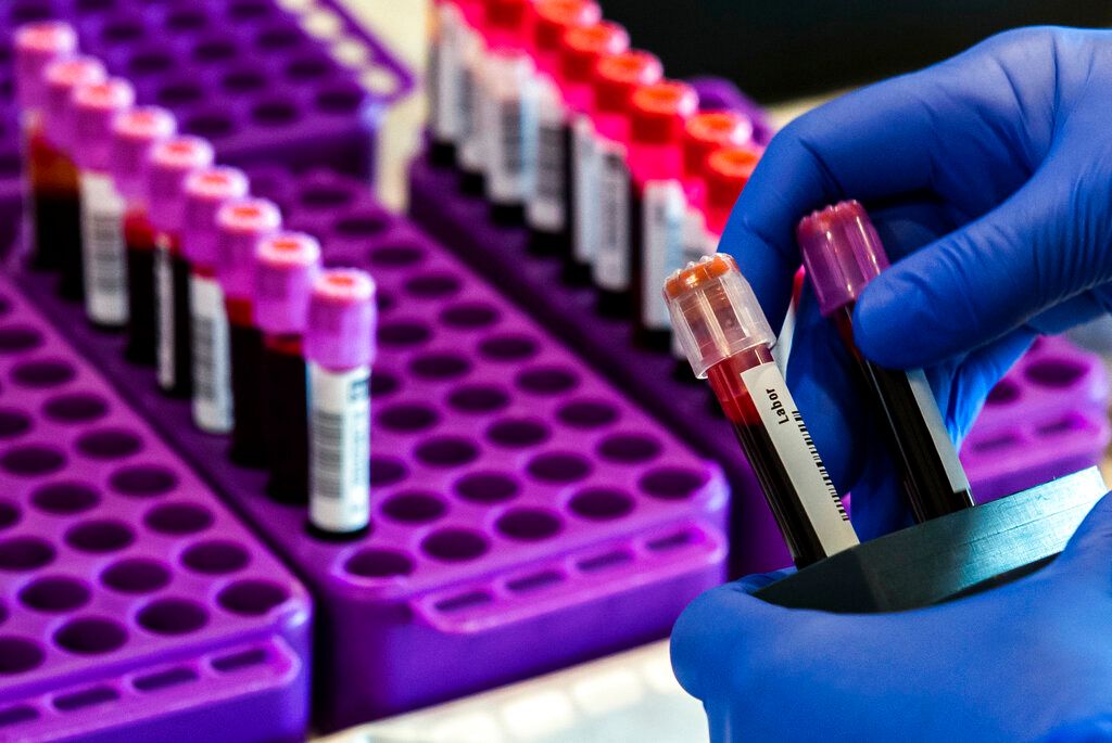 Do You Need Someone With You for a Blood Test at Home?