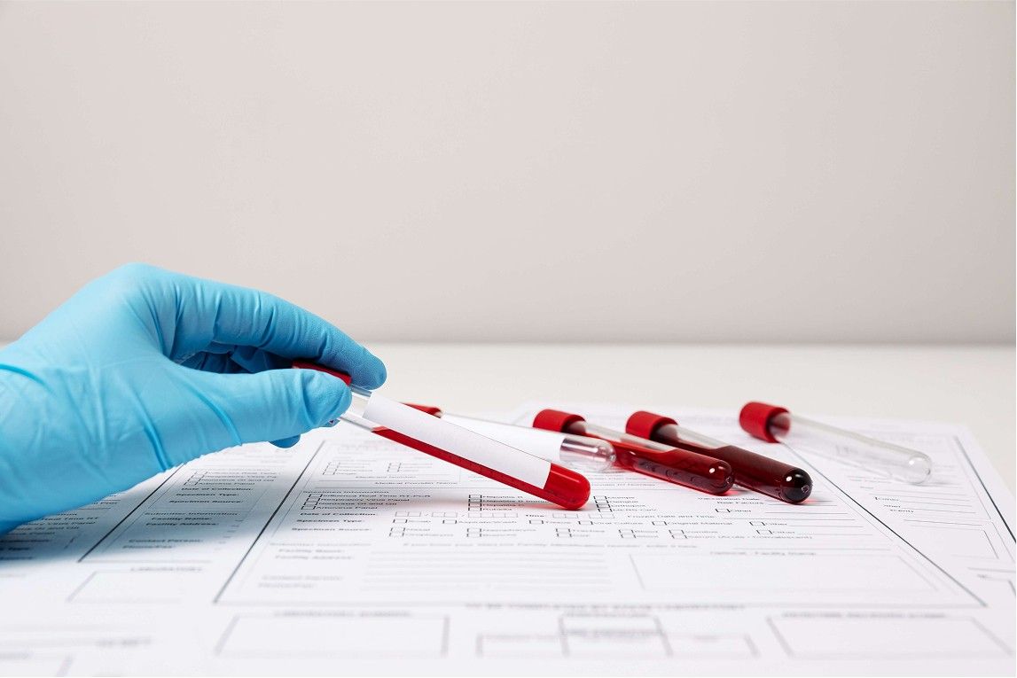 Can Blood Test at Home Detect Malnutrition?