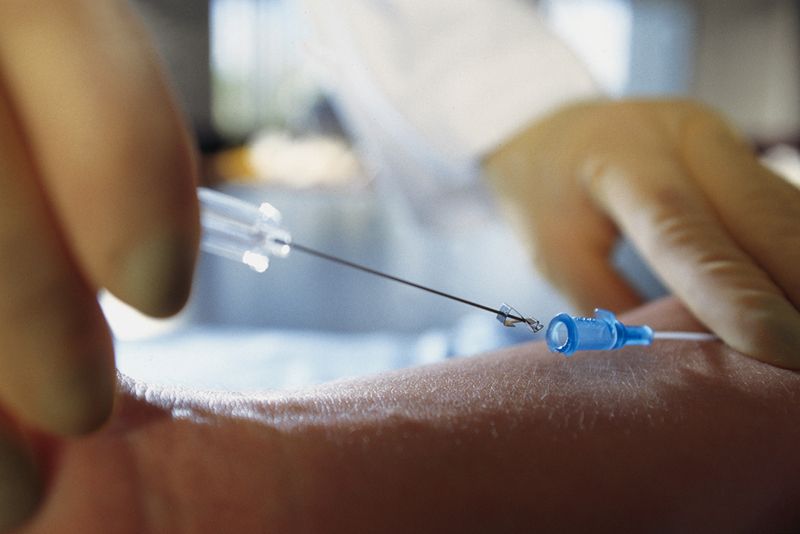The History of IV Drip in Medical Care