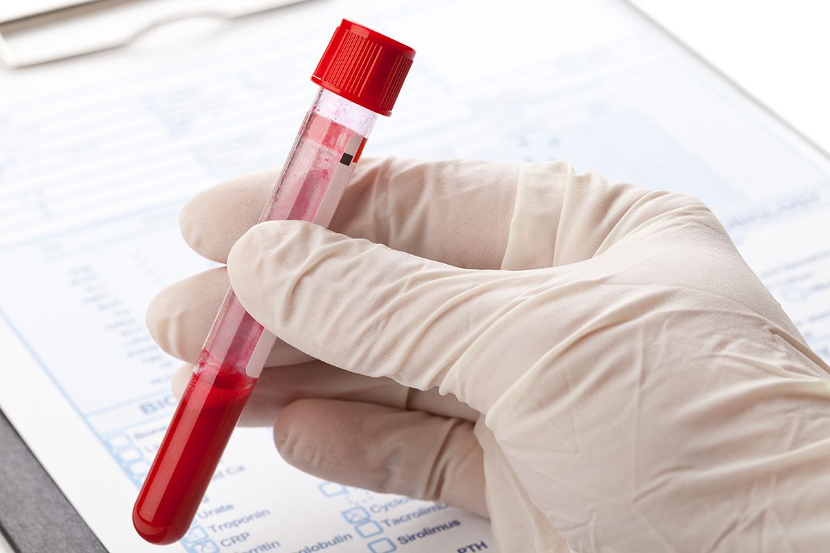 Blood Test at Home: Monitor Nutritional Gaps Comfortably