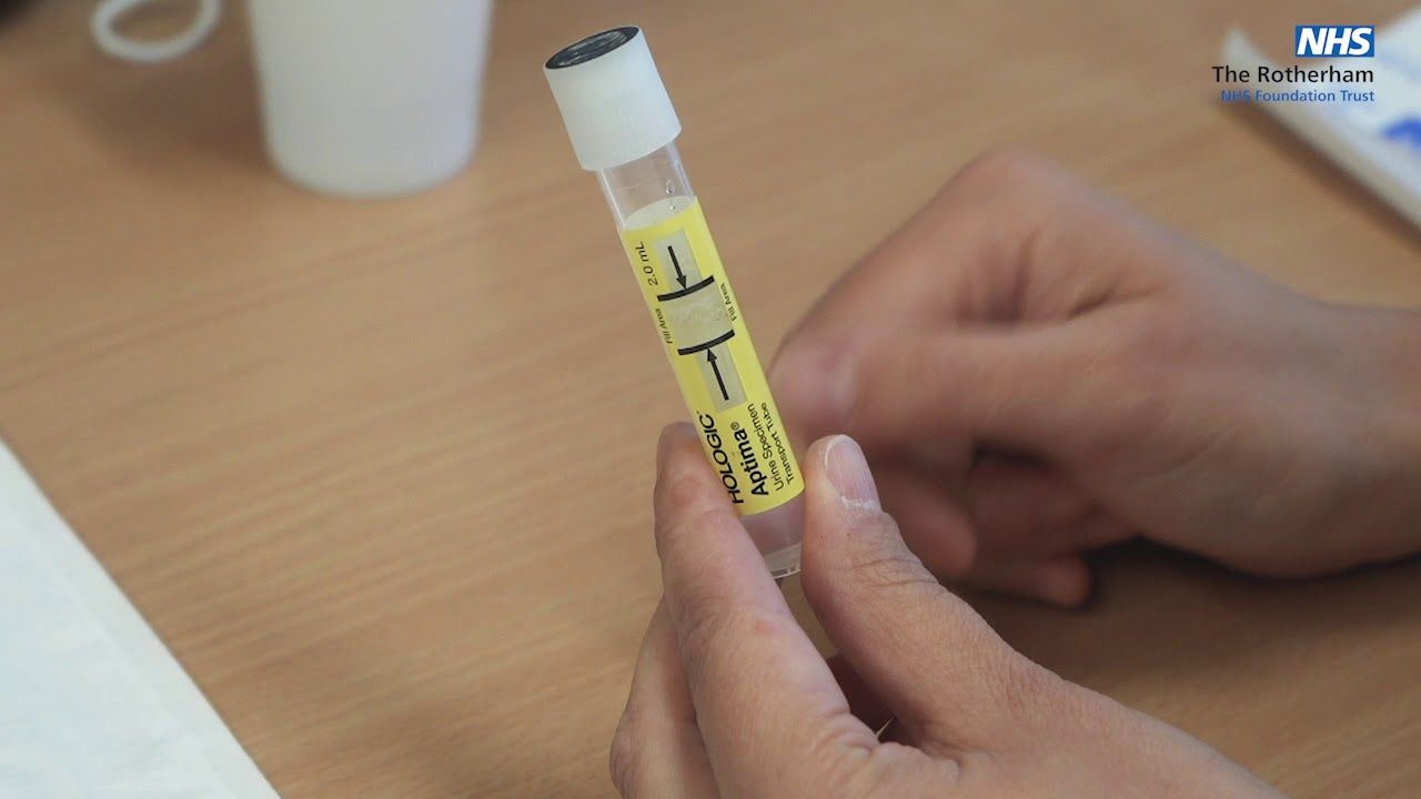 Can an STD Test Detect Herpes?
