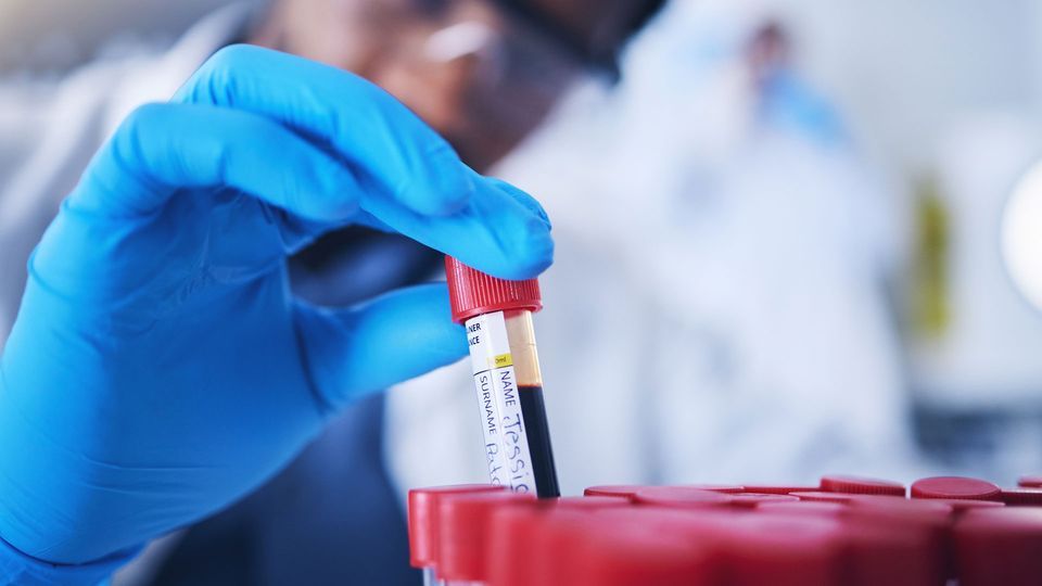 Blood Test at Home: Monitoring Your Vital Biomarkers