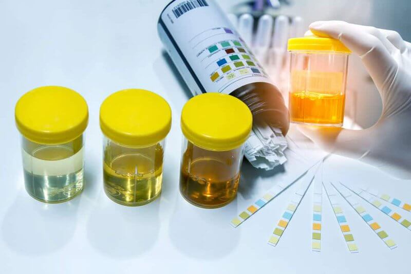 Can Doctor at Home Do Urine Tests?