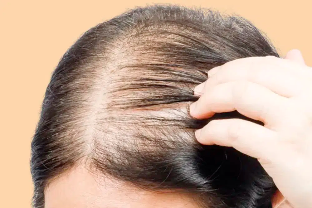 Practical Advice for Evaluating Finasteride 1mg Price