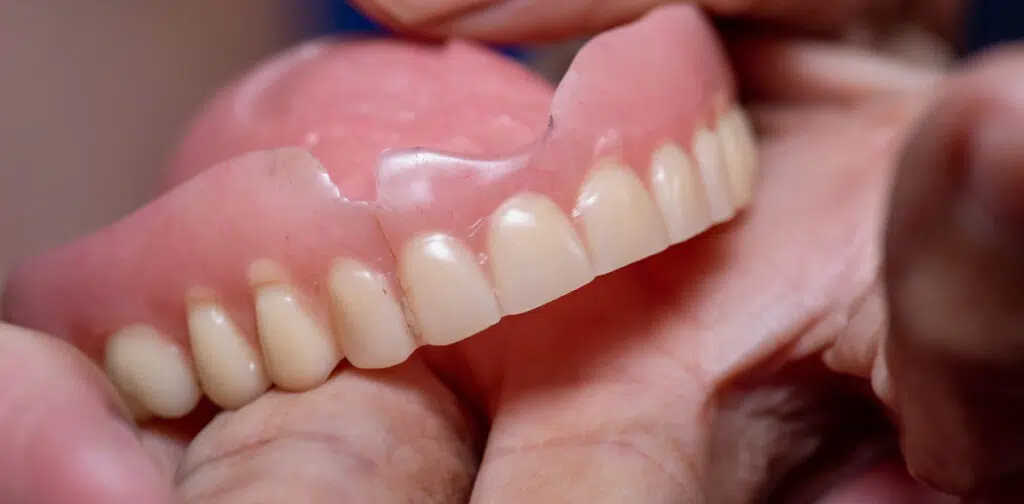 Dental Crowns and Bridges After Tooth Damage or Decay
