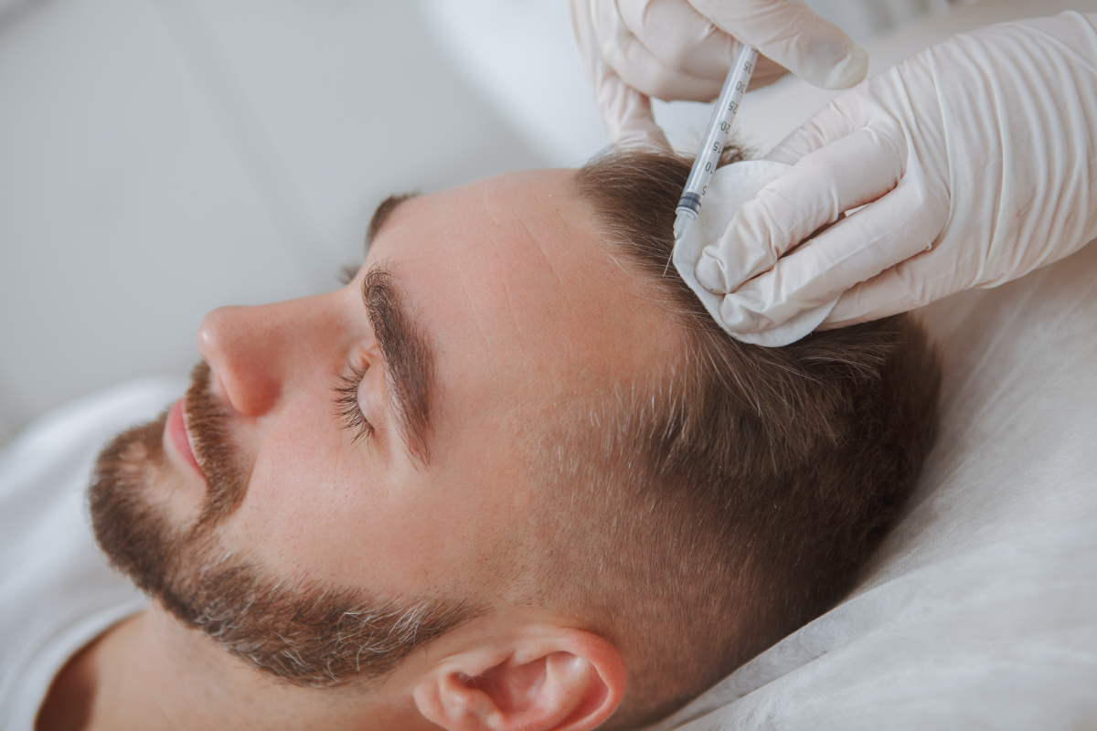 Best PRP Hair Treatment for Patchy Hair Loss