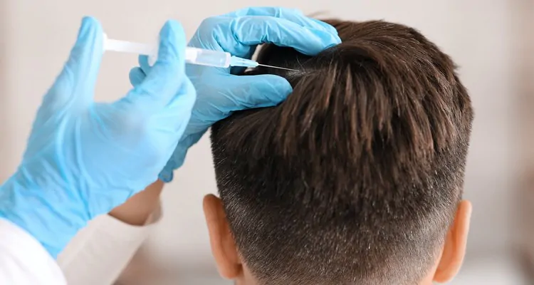 How the Best PRP Hair Treatment Supports Scalp Health