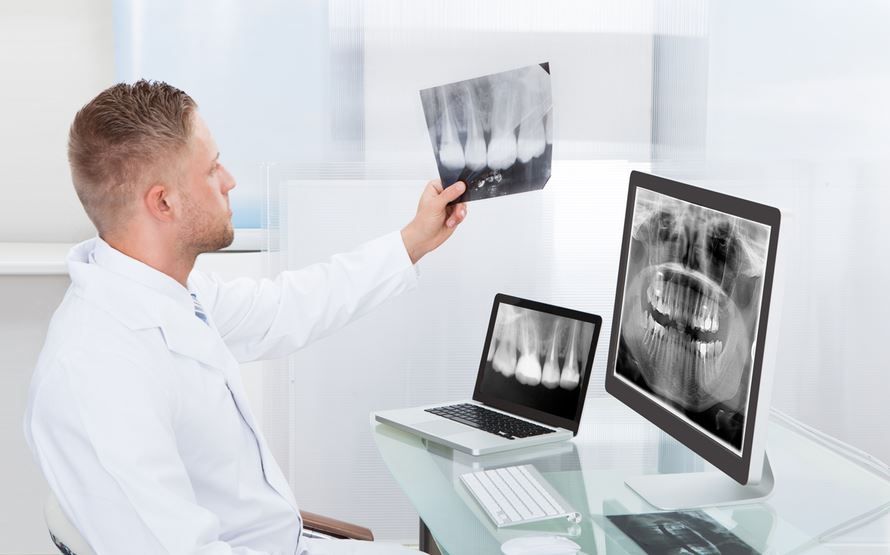 Panoramic Dental X-Ray for Orthodontic Evaluations