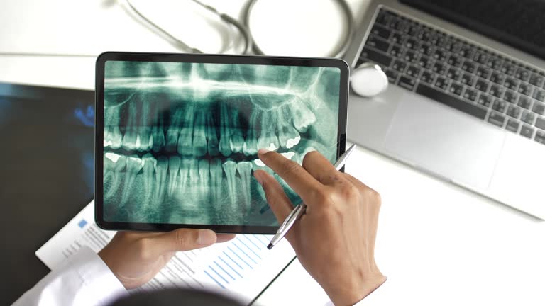 Why Panoramic Dental X-Ray Cost Matters for Oral Health