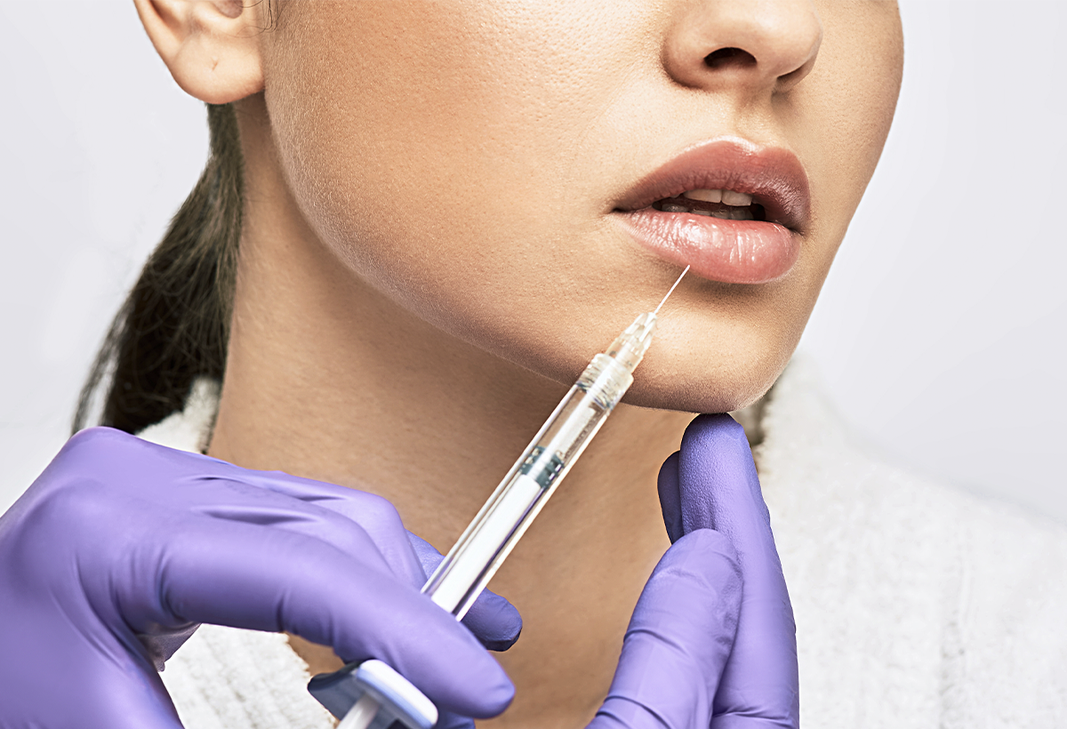 Juvederm Fillers for Smile Lines: How They Help