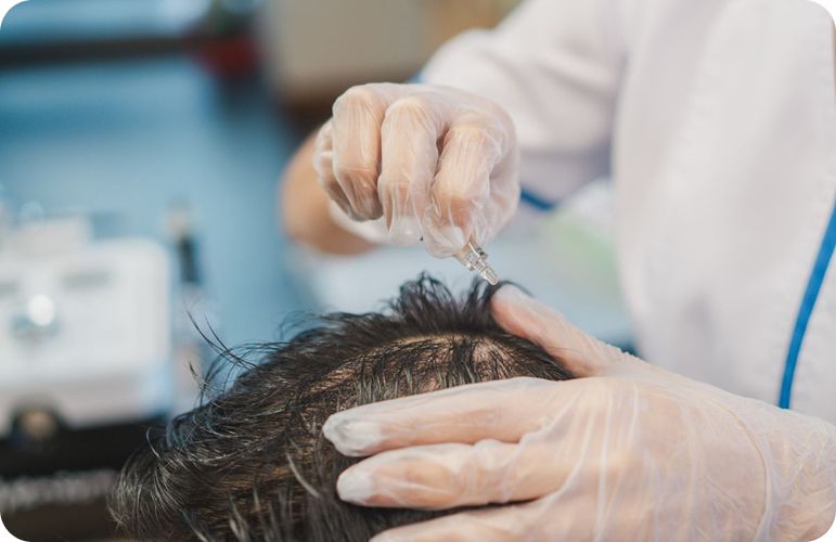 How to Track Progress With the Best PRP Hair Treatment