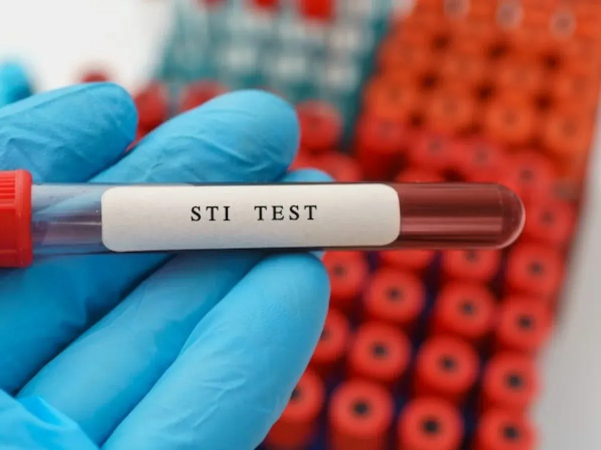 STD Test Advice for Women