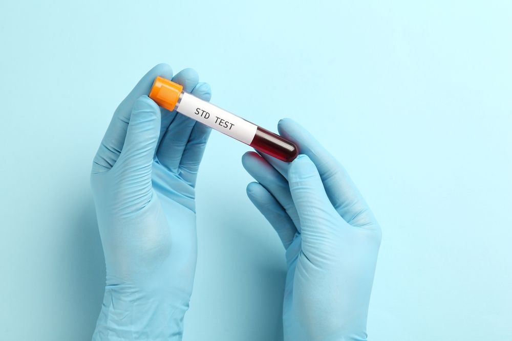 Hepatitis B and C Detection in an STD Test