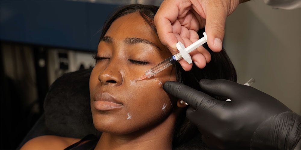 Top Benefits of Profhilo Treatment