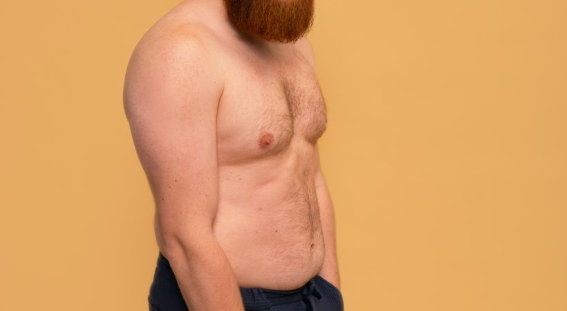 Laser vs Traditional Gynecomastia Surgery Cost