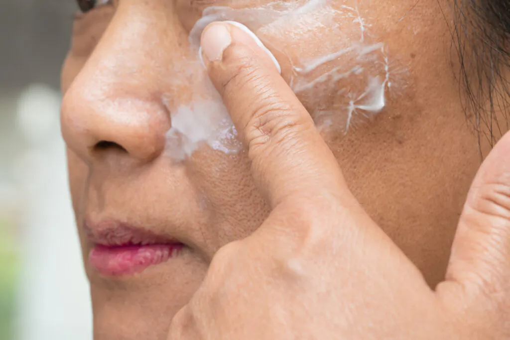 Quick Fixes to Support Melasma Treatment