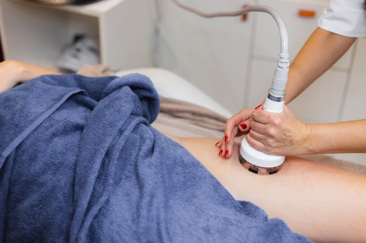 CoolSculpting for Fat Loss: How It Differs from Weight Loss
